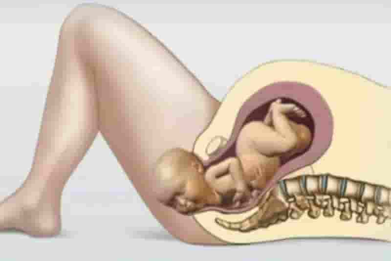 الولادة الطبيعية