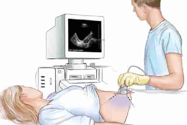 موجات صوتية للنساء والحمل
