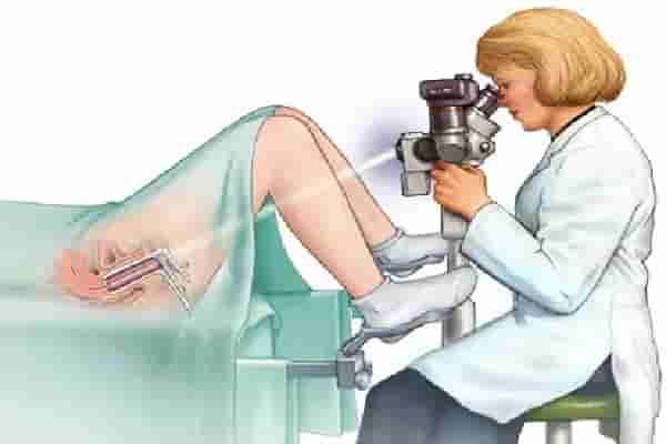 منظار المهبل او  تنظير المهبل