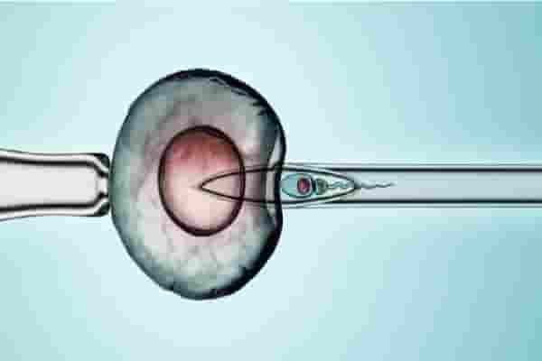 الحقن المجهري