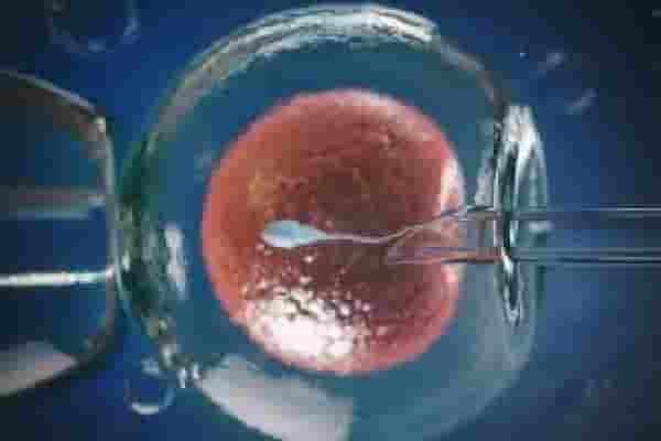 دكتورة متخصصة فى الحقن المجهرى